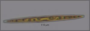 Diatom