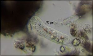 Amoeba