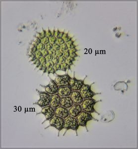 Green algae, Pediastrum genus